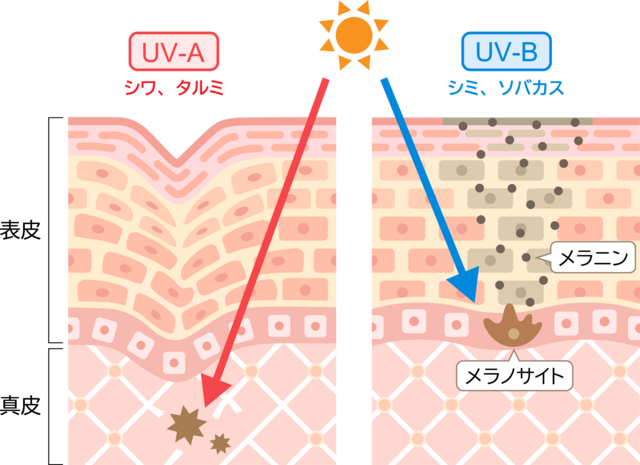 紫外線の影響