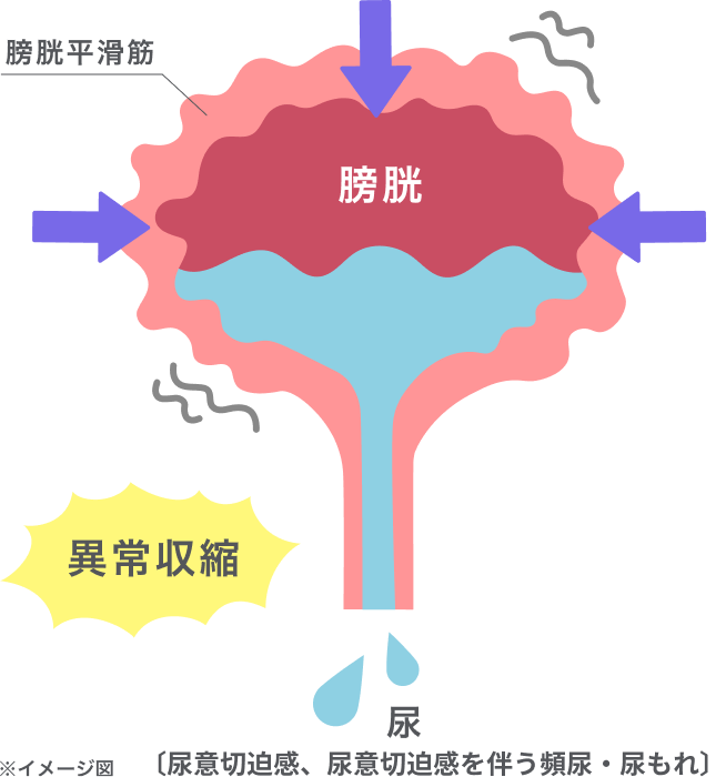 過活動膀胱の原因